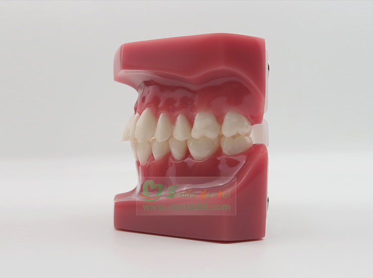 TM-B6 Orthodontic Model